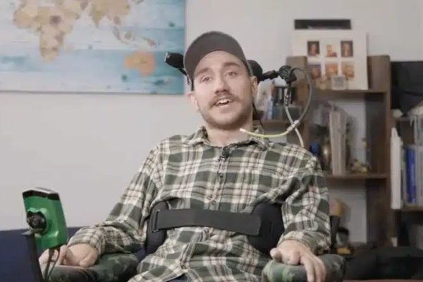 Первый пациент с Neuralink провел один год с имплантатом в его голове - побочные эффекты не имеют