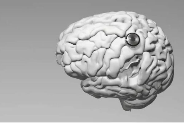 Любой уже может стать волонтером для имплантации нейронных чипов Neuralink