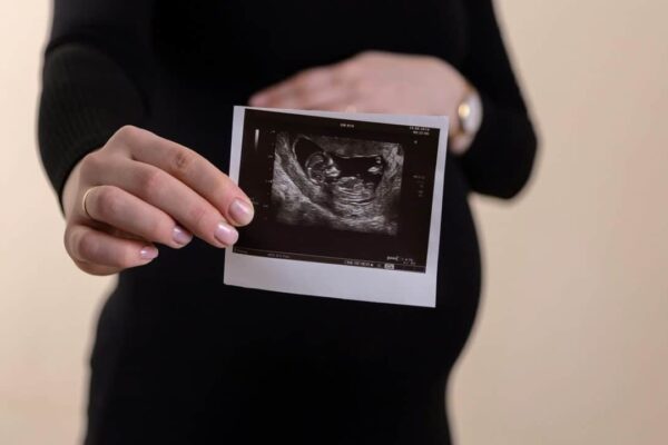 Это приложение превратит ваш смартфон в монитор сердечного ритма плода